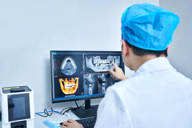 Best Emergency Wisdom Teeth Removal in Hartwell, GA